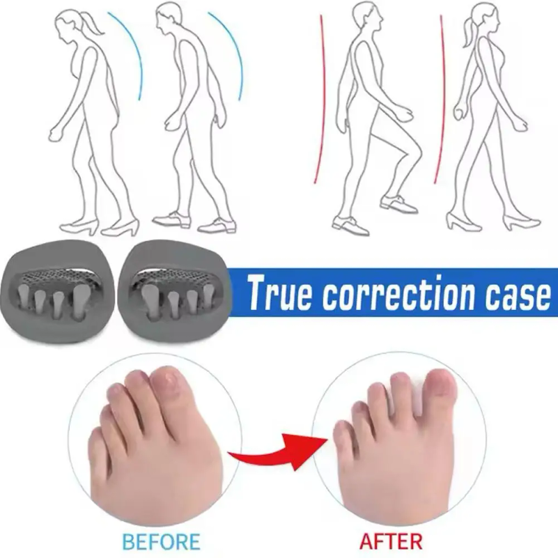 Chinelos para Correção de Pern - Home Improvement Man avaliação e preço